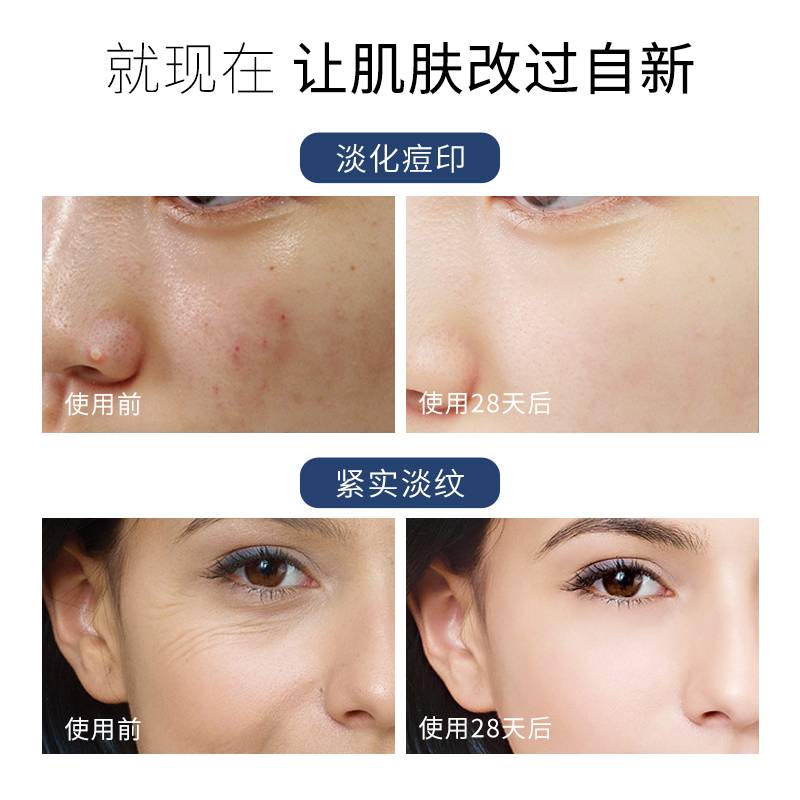 梵西蓝铜胜肽修护冻干粉 44支/盒 寡肽原液去淡化祛痘印痘坑收缩毛孔